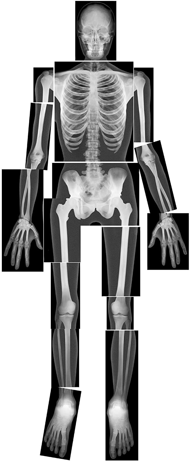 Roylco True to Life Human X-Rays